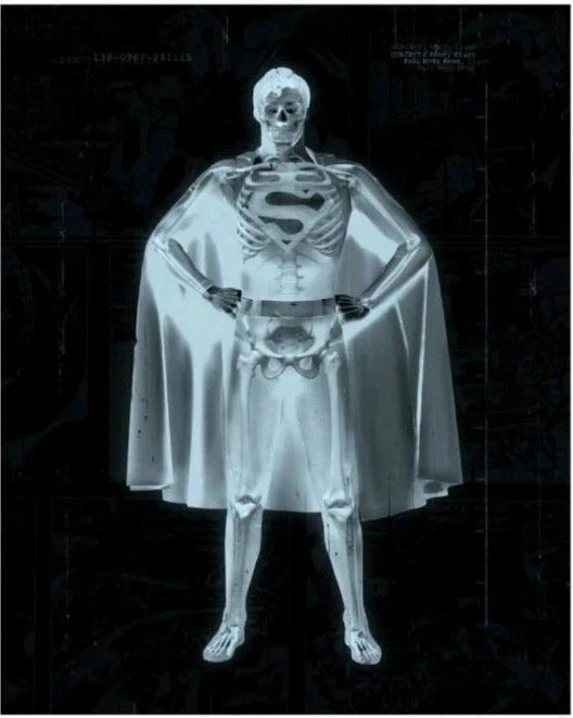 JJ Adams Signed Limited Edition - Clarke Superman X-ray Artwork Print Framed - LRBinteriors